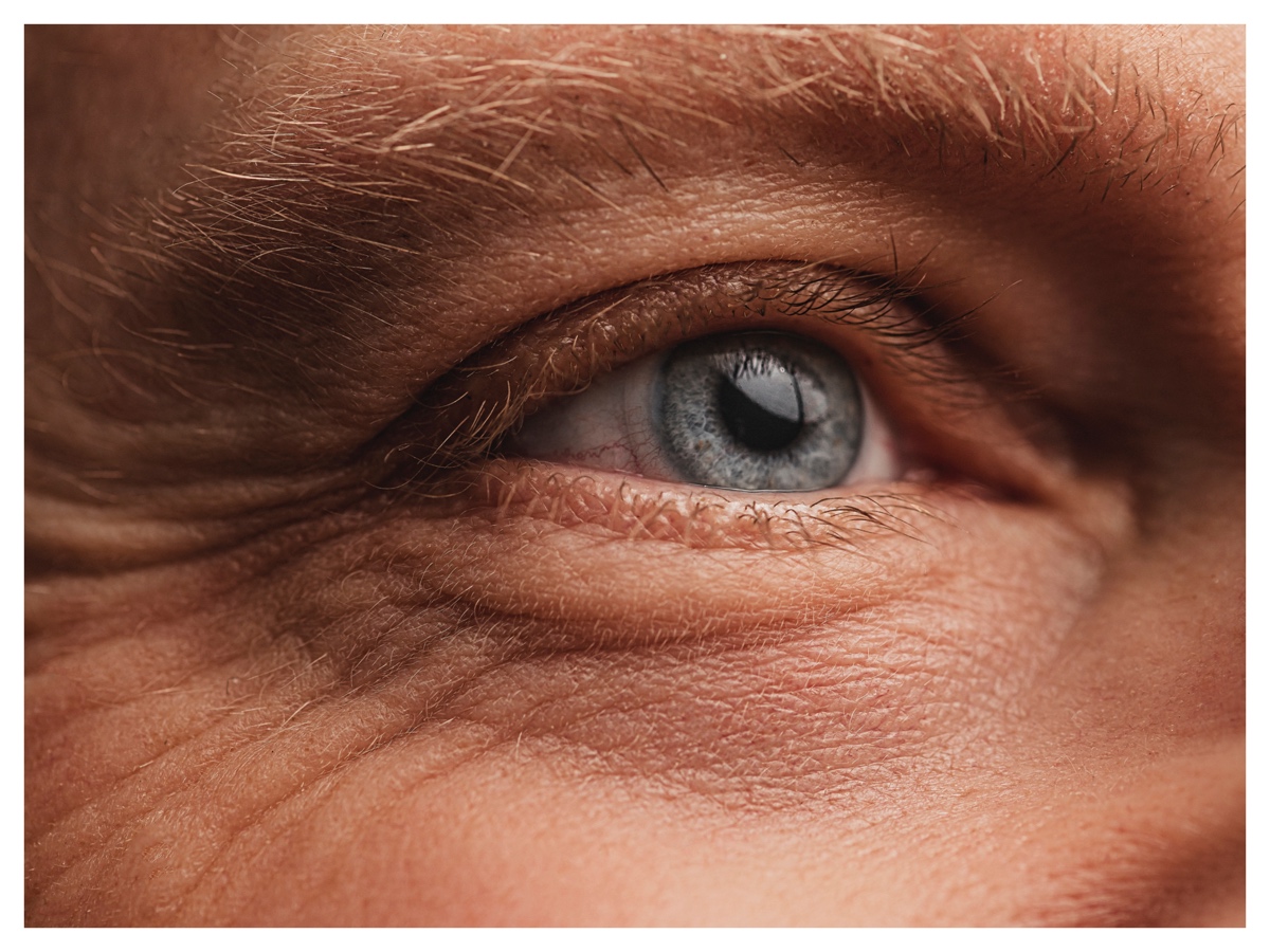 biostimolazione biorivitalizzazione consigli esperto 02
